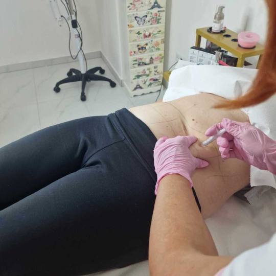 Signature #tuzla Tretmani tijela Lipoliza 10 ml