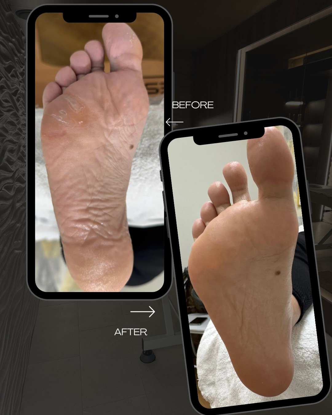 Magnifiqe beauty house #sarajevo Estetski pedikir Estetska pedikura