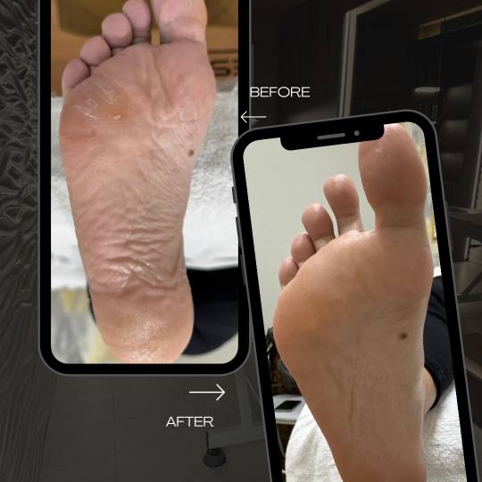 Magnifiqe beauty house #sarajevo Estetski pedikir Estetska pedikura