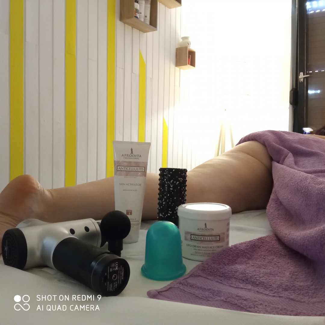 Nervus #banjaluka Anticelulit masaža Anticelulit masaža