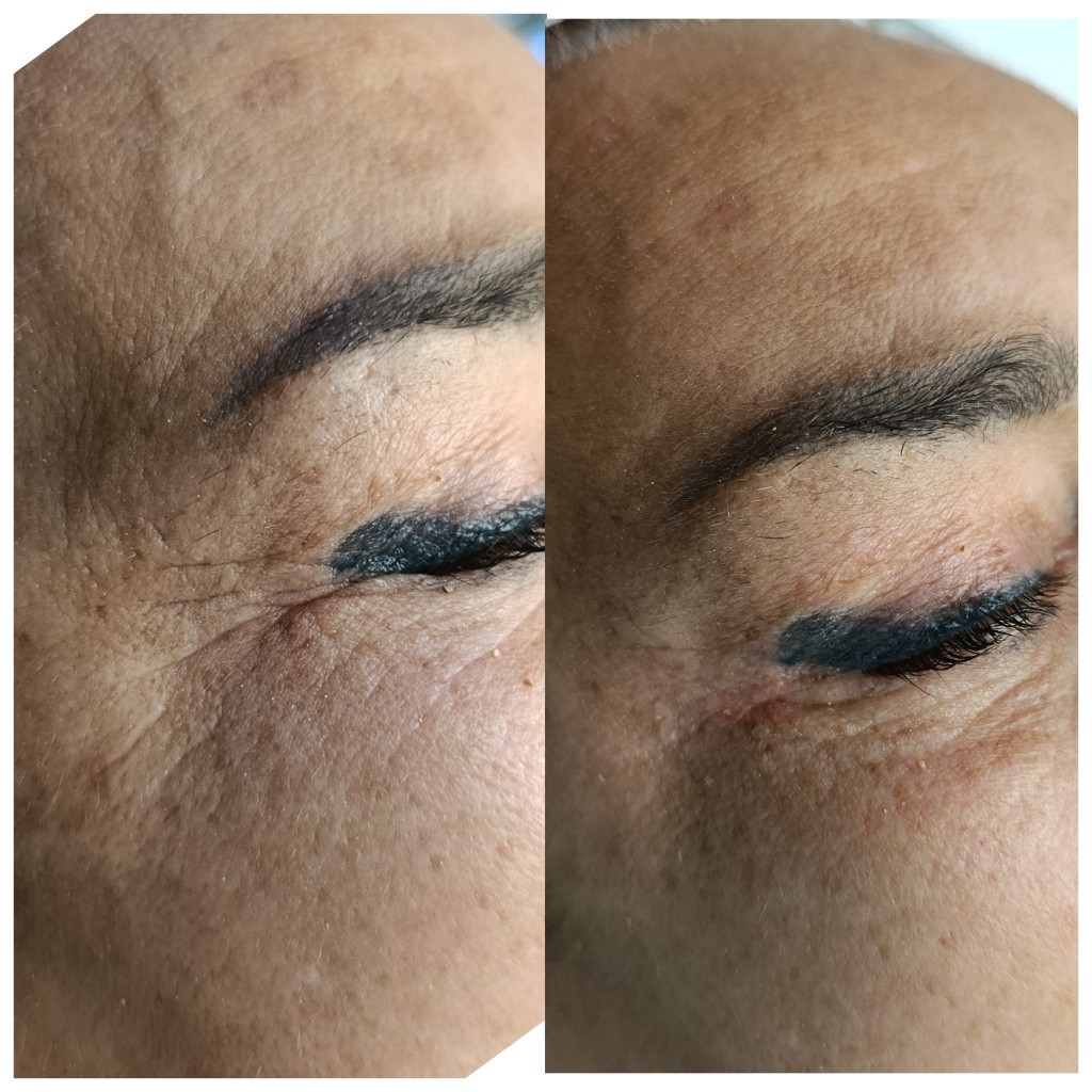 Soovica by Lida #tuzla