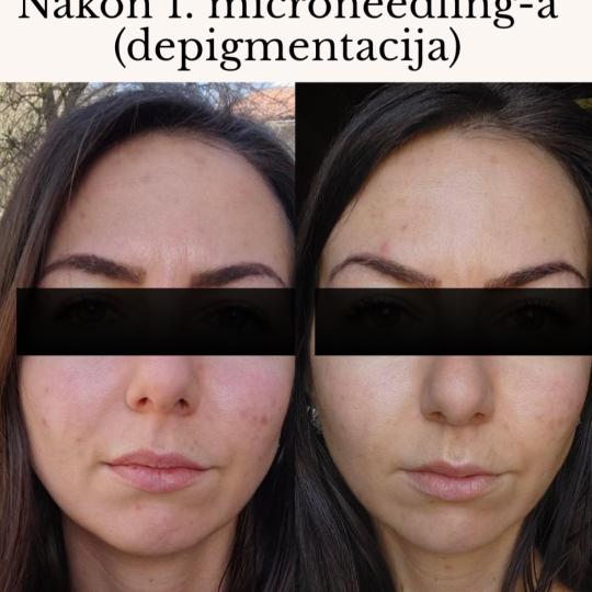 Sakina usluga