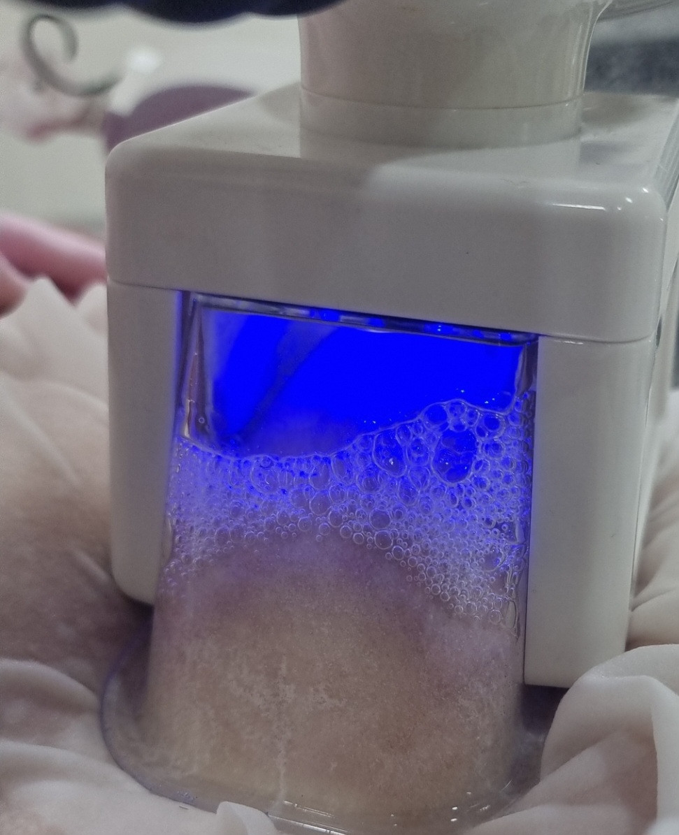 Sandra #visoko Tretmani za mršavljenje Kriolipoliza - tretman uklanjanja masnih naslaga - 2 sonde