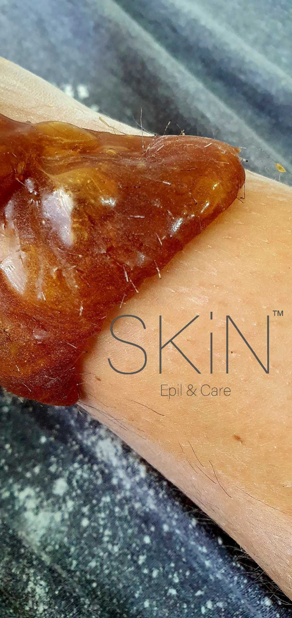 Skin Epil & Care #sarajevo Depilacija šećernom pastom Depilacija cijelih nogu šećernom pastom - za dame