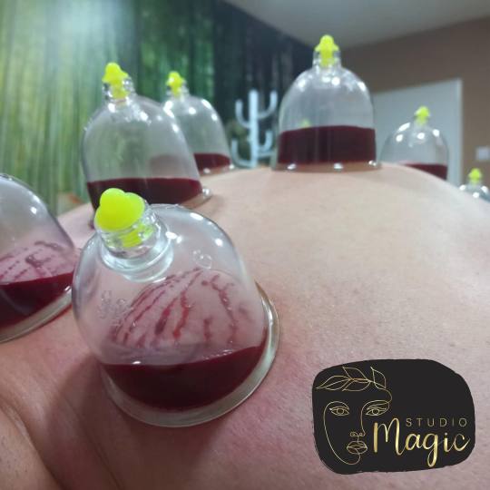 Magic #sarajevo Tretmani tijela Hidžama - leđa