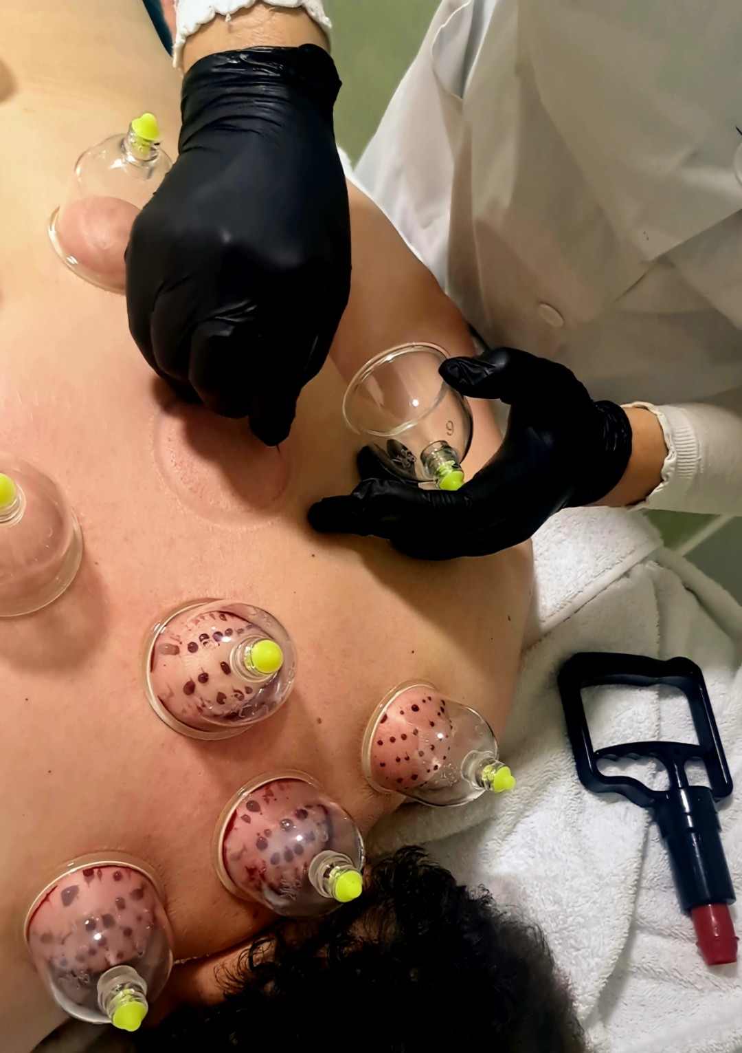 Magic #sarajevo Tretmani tijela Hidžama - leđa