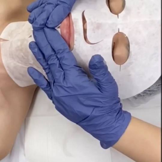 Rebloom #sarajevo Tretman lica Rebloom No botox revital tretman - Carboxy tretman oksigenacije