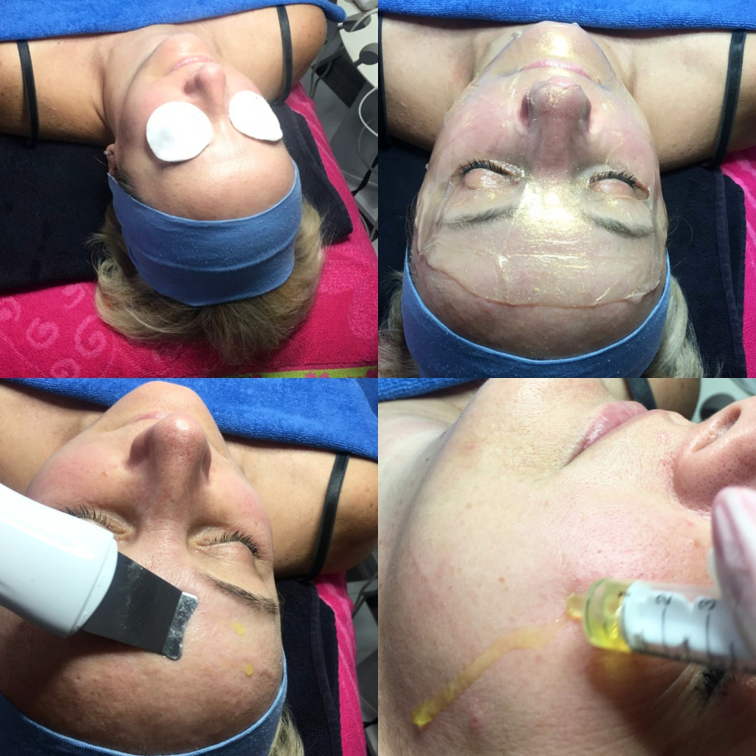 Fresh #sarajevo Tretman lica