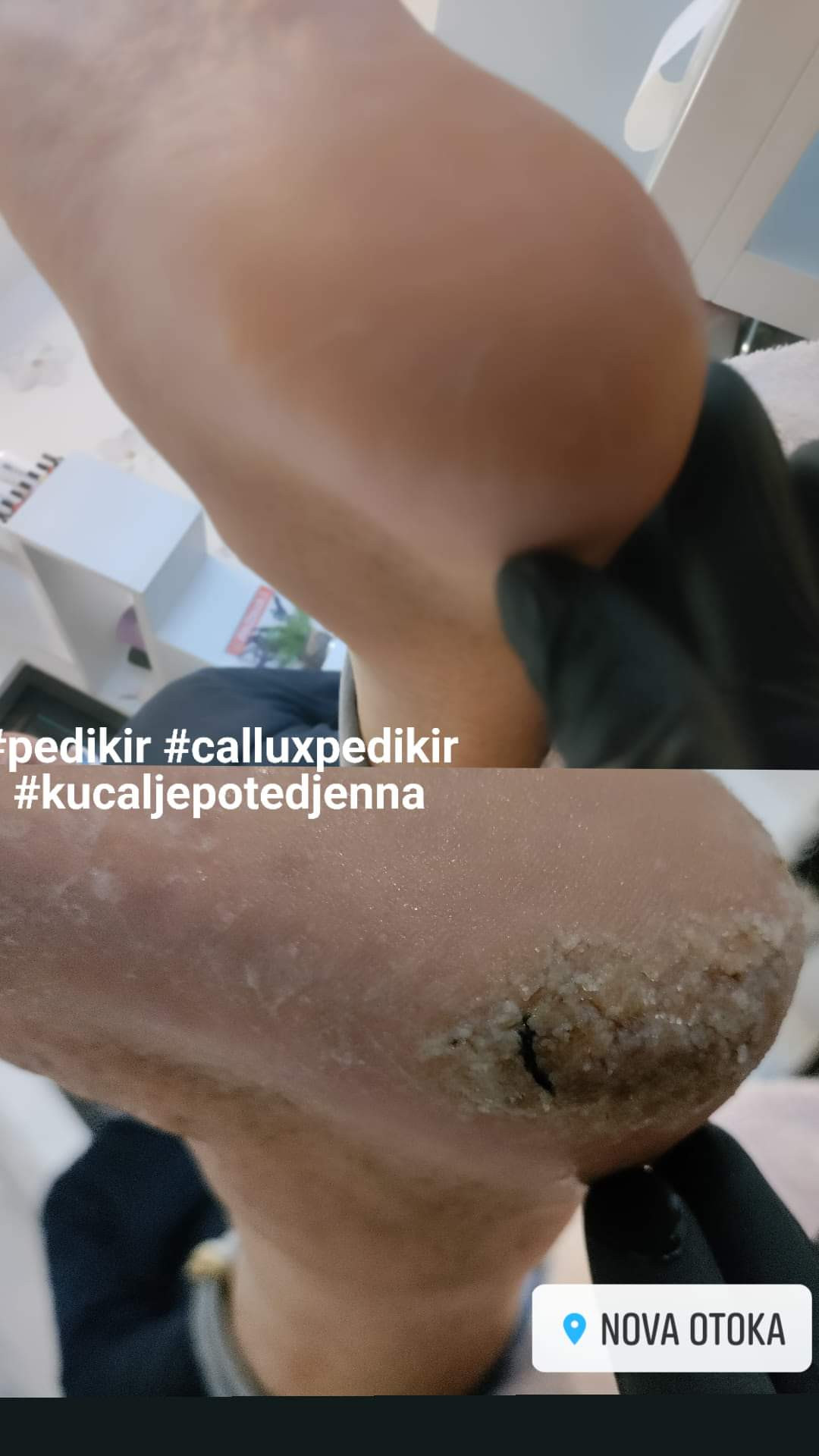 Kuća ljepote Djenna #sarajevo Medicinski pedikir Medicinski pedikir