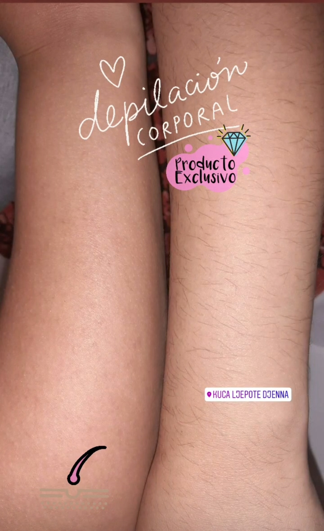 Kuća ljepote Djenna #sarajevo Depilacija šećernom pastom Depilacija ruku šećernom pastom