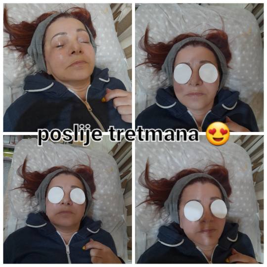 Poezija ljepote #sarajevo Ojačavanje noktiju Tretman zlatnim + srebrnim nitima lice