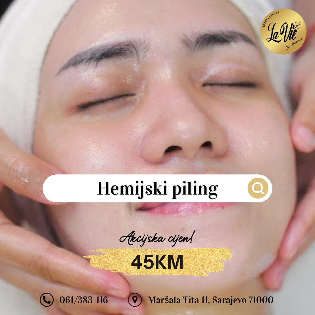 Hemijski piling - La Vie beauty centar, Sarajevo Tretman lica Lice Tretman lica, Sarajevo, Centar - Stari Grad