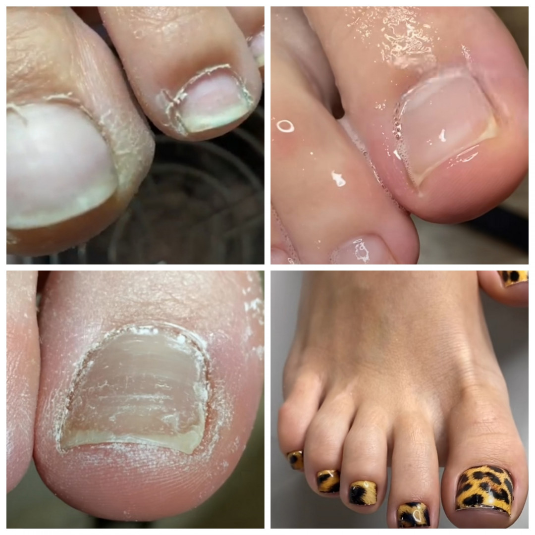 Poezija ljepote #sarajevo Estetski pedikir Klasična pedikura + trajni lak