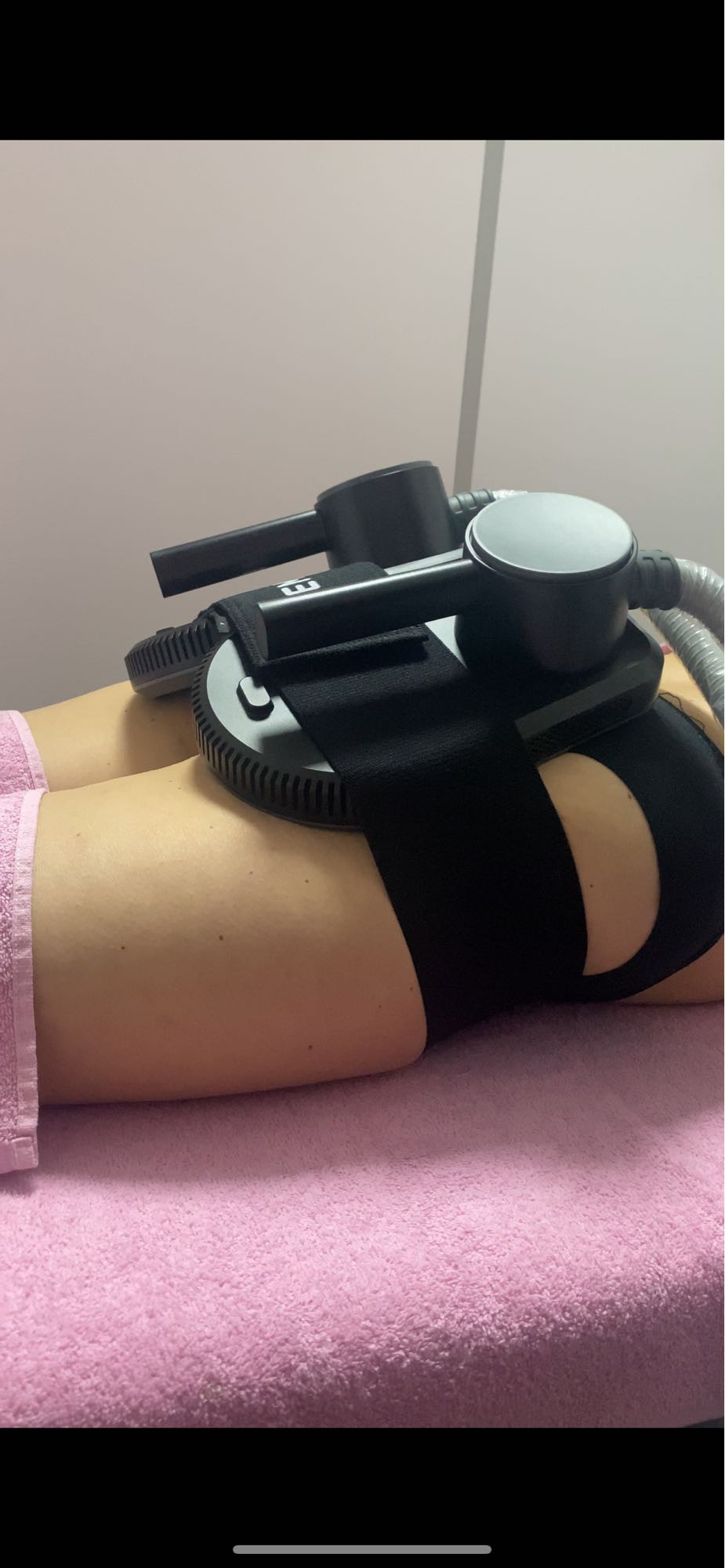 Laser Beauty Studio #visoko Tretman lica Stimulacija i definicija mišića 2 sonde - paket od 8 tretmana