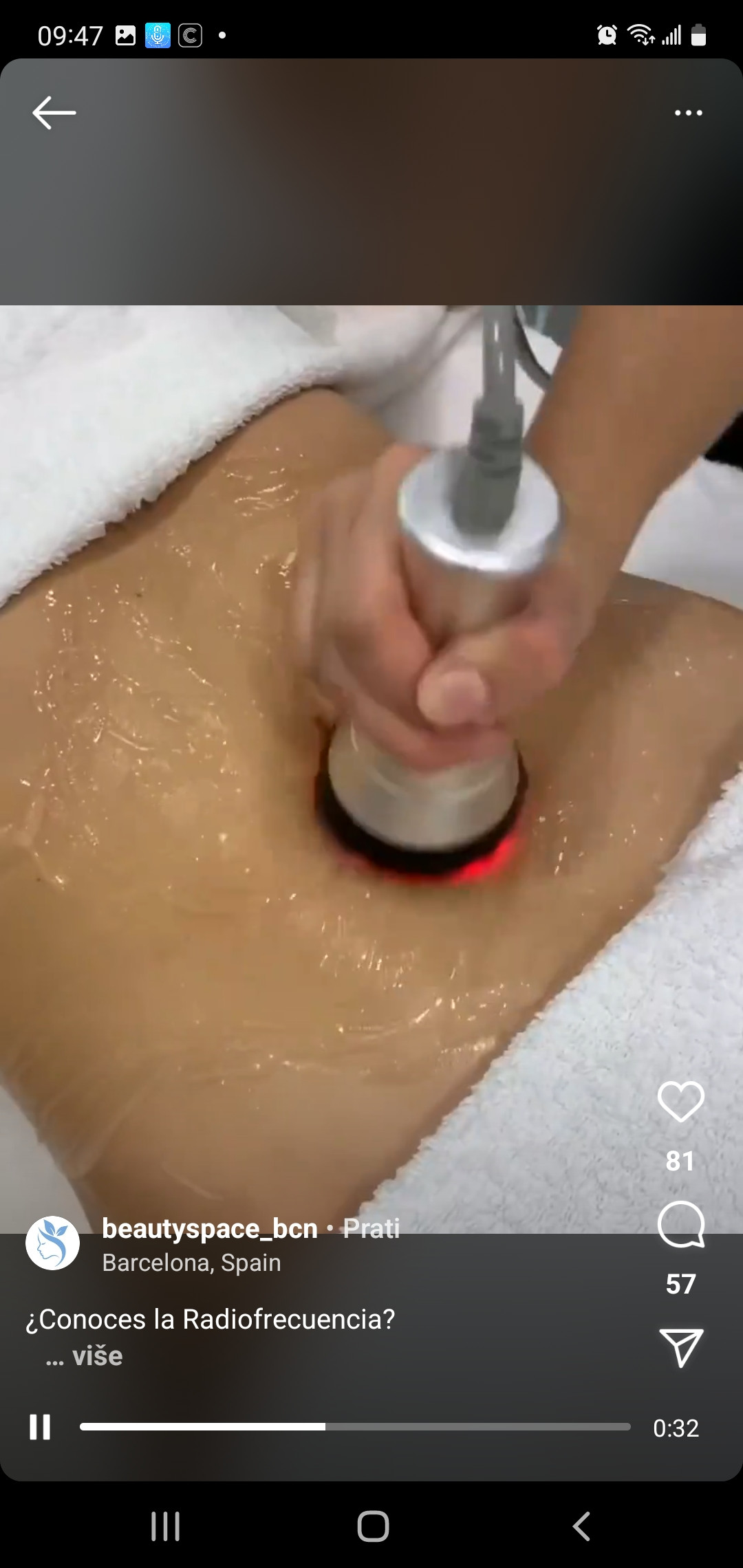 Sandra #visoko Tretmani tijela Kavitacija - stomak