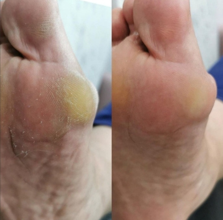 Poezija ljepote #sarajevo Estetski pedikir Ruska pedikura - bez laka