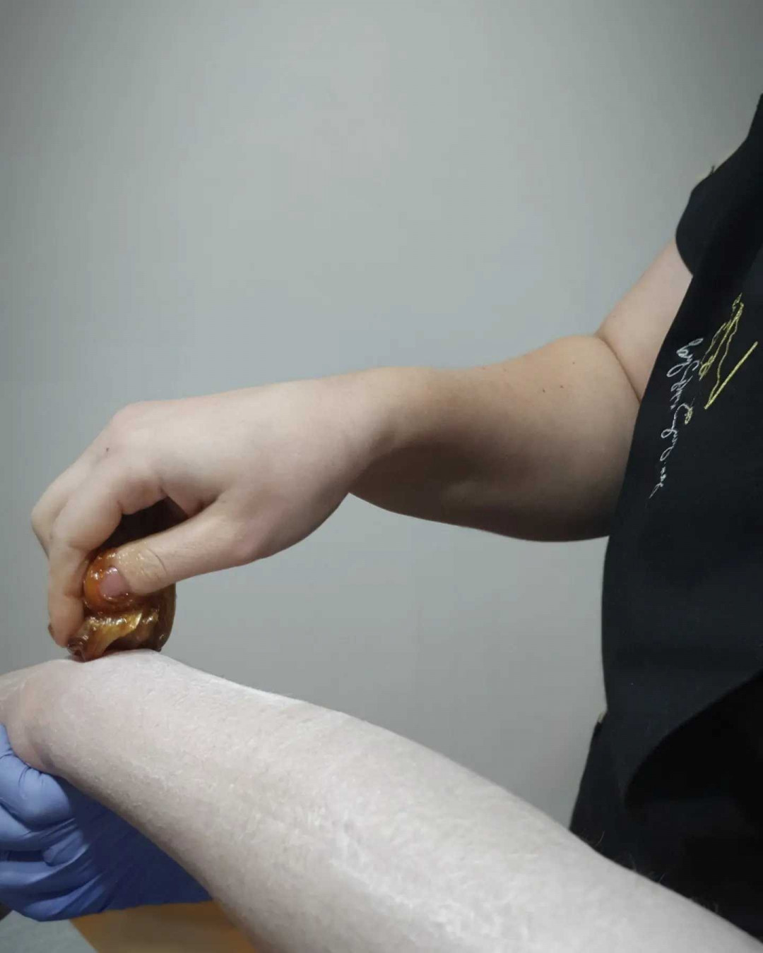 Skin Epil & Care #sarajevo Depilacija šećernom pastom Depilacija cijelih ruku + pazuha šećernom pastom - za dame