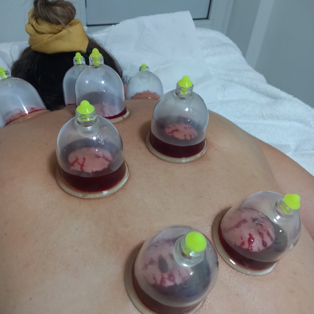 Magic #sarajevo Tretmani tijela Hidžama - leđa