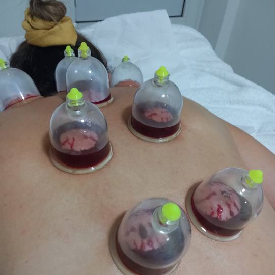 Magic #sarajevo Tretmani tijela Hidžama - leđa