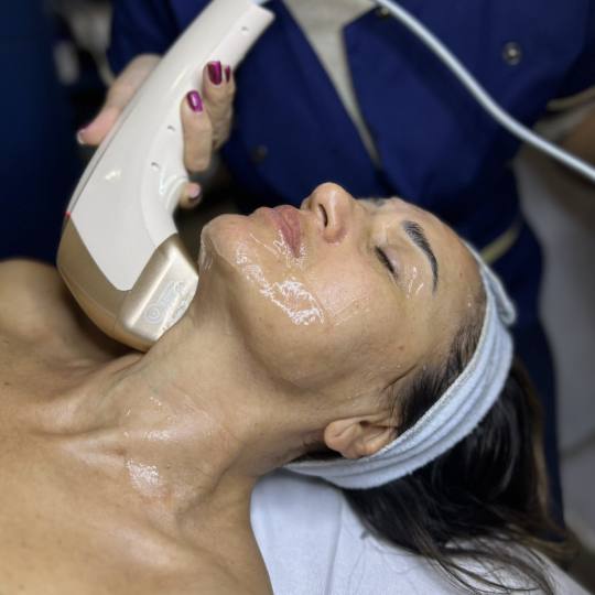 Angels Beauty - Banja Luka #banjaluka Tretman lica HIFU tretman - čelo + oči + obrazi