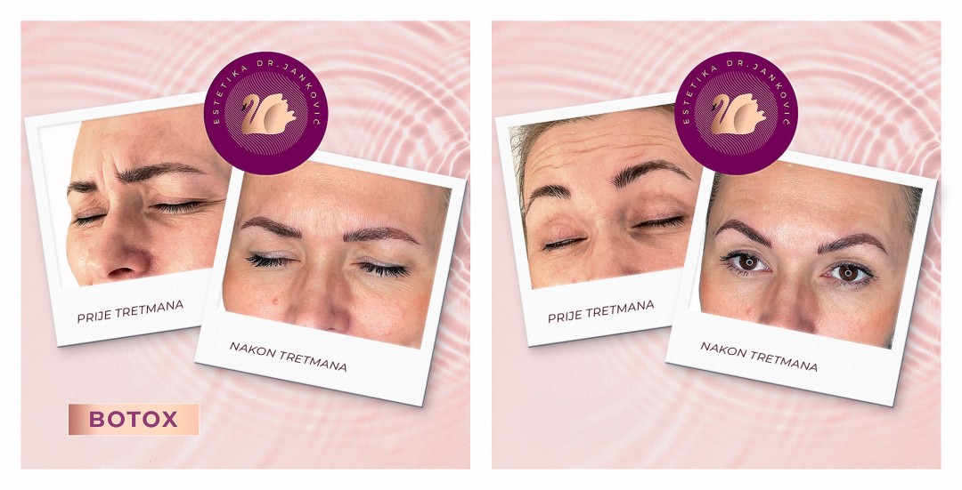 Estetika Janković #banjaluka