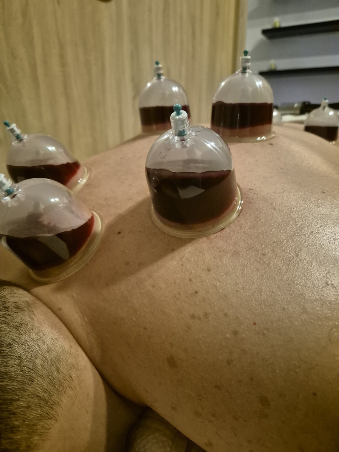 Hidžama classic - Health Care Koncept, Sarajevo Tretmani tijela Tijelo Tretmani tijela, Sarajevo, Novo Sarajevo - Novi Grad