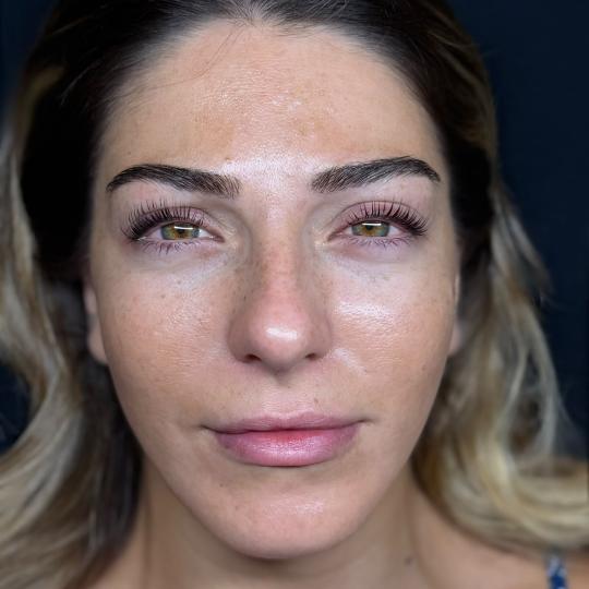 Elan beauty by Amra #sarajevo Obrve Brow lift