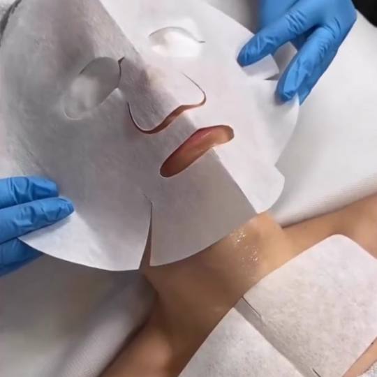 Rebloom #sarajevo Tretman lica Rebloom No botox revital tretman - Carboxy tretman oksigenacije