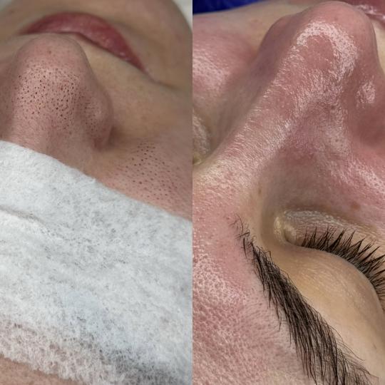 Hanas Skin Centar usluga