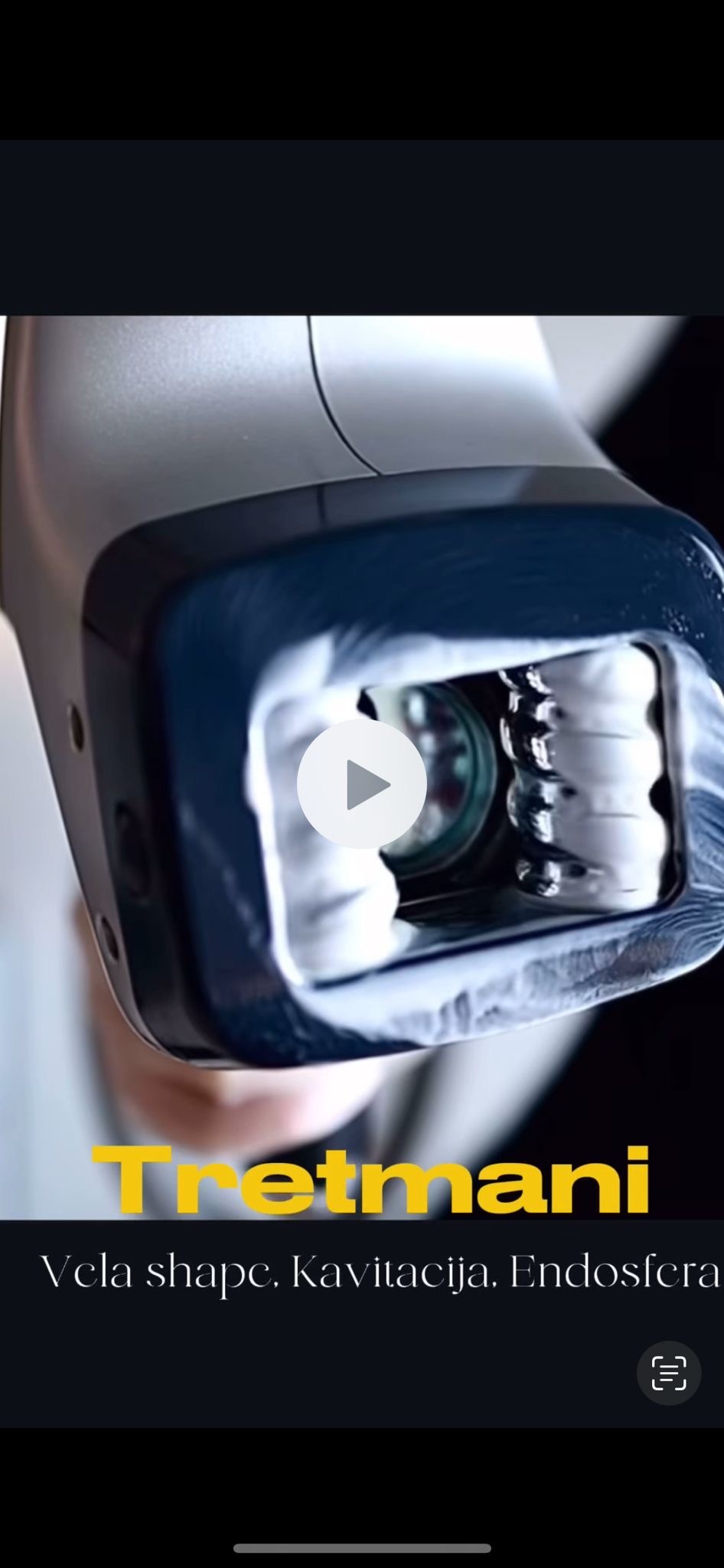 Beauty studio Luxe #sarajevo Anticelulit masaža VelaShape Platinum tretman - noge + gluteus + stomak