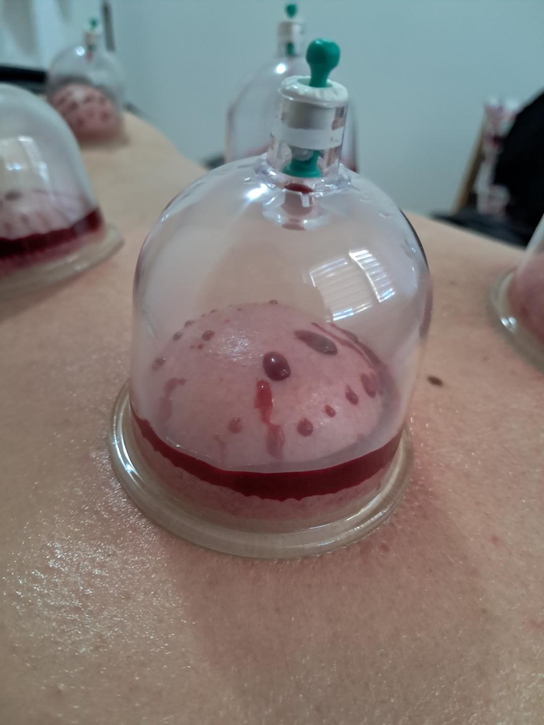 Sakina #sarajevo Hidžama Fokusirana hidžama - 4 do 6 tačke