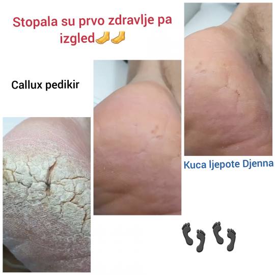 Kuća ljepote Djenna #sarajevo Estetski pedikir Callux pedikir
