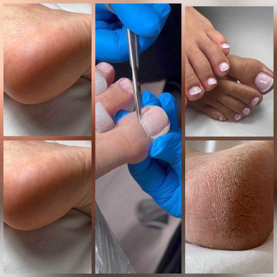 Poezija ljepote #sarajevo Estetski pedikir Klasična pedikura + trajni lak