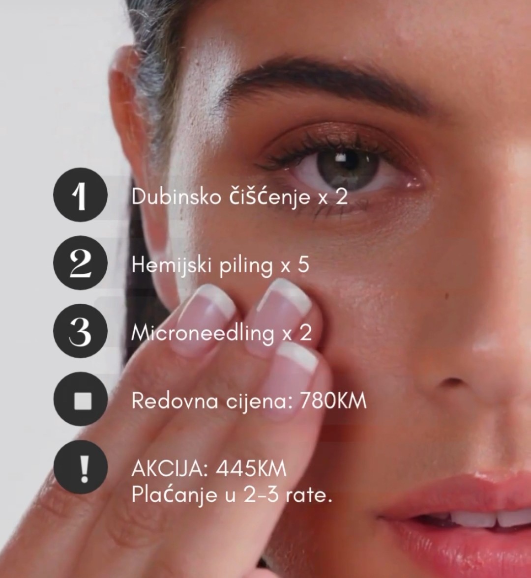 Fabrika ljepote #sarajevo Tretmani tijela Paket tretmana za pigmentacijske fleke