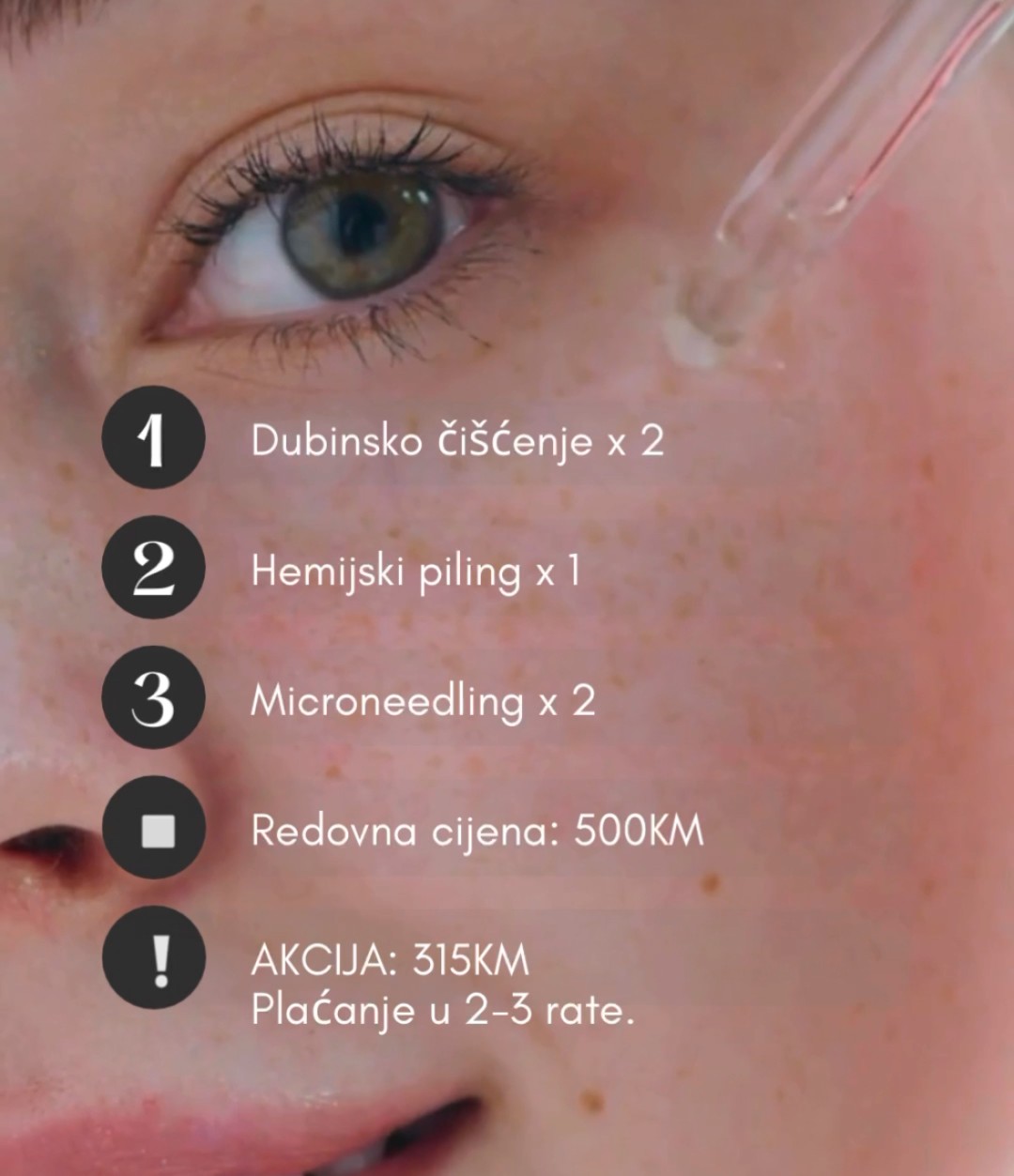 Fabrika ljepote #sarajevo Tretmani tijela Paket tretmana za suhu kožu