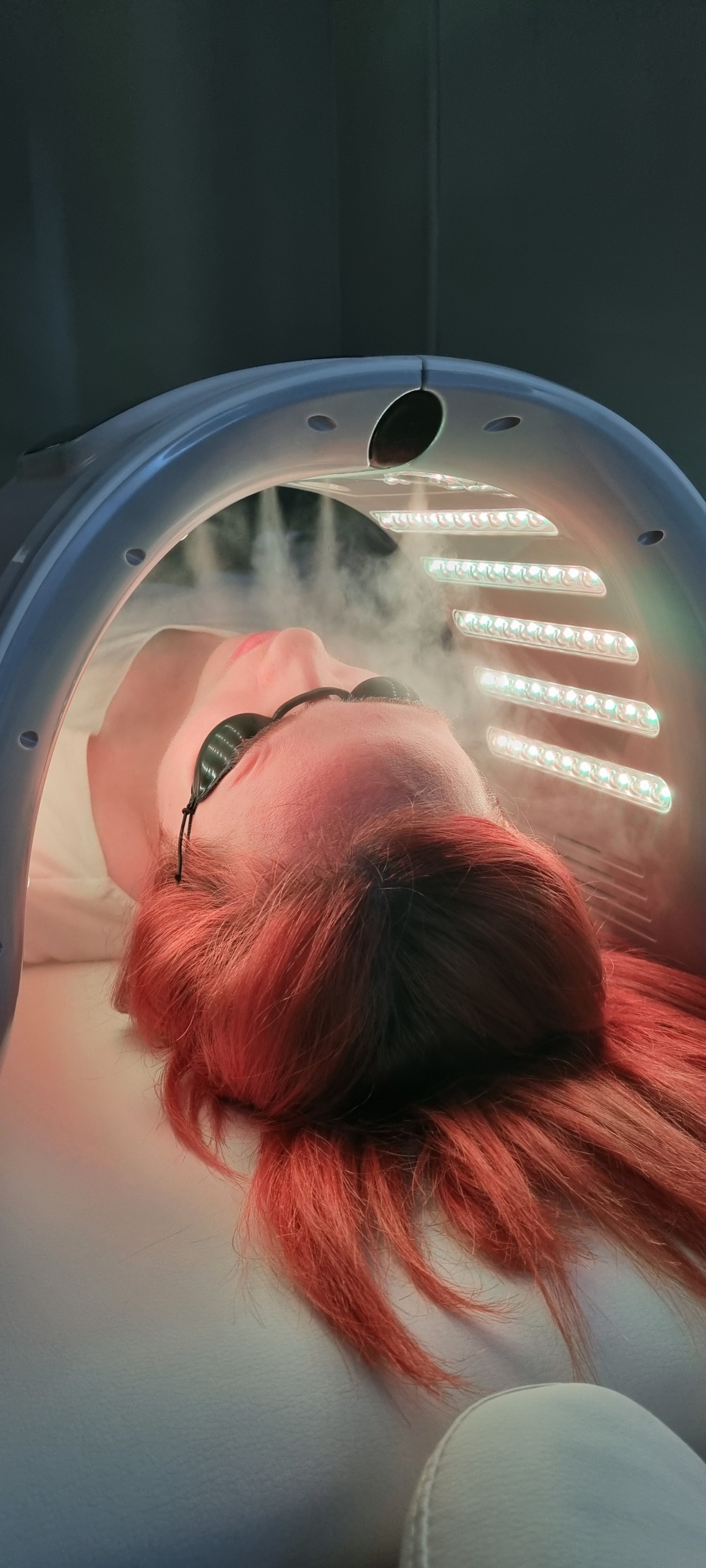 Revidir #gradiska Tretman lica Fotodinamska terapija