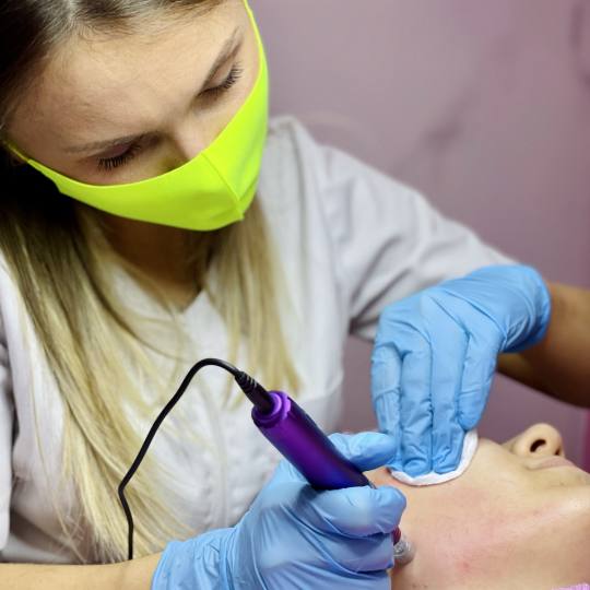 AEsthetic Bar Academy #sarajevo Tretman lica Microneedling - protiv akni i ožiljaka