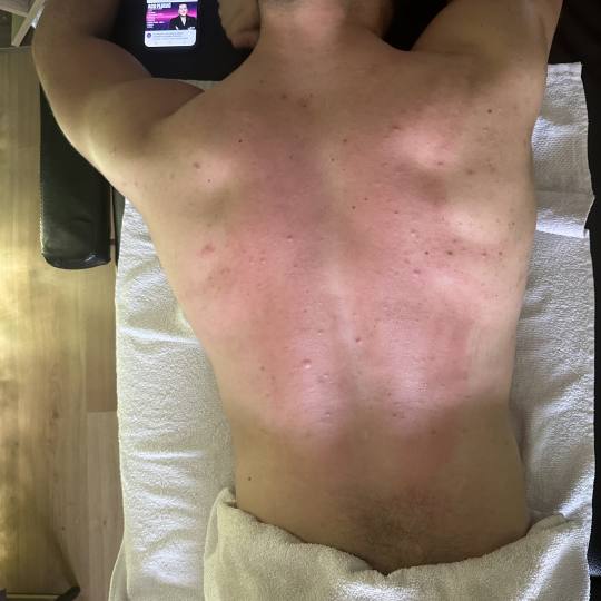 Black Diamond - Ilidža #sarajevo Klasična masaža Sportska masaža cijelog tijela Sportska masaza 