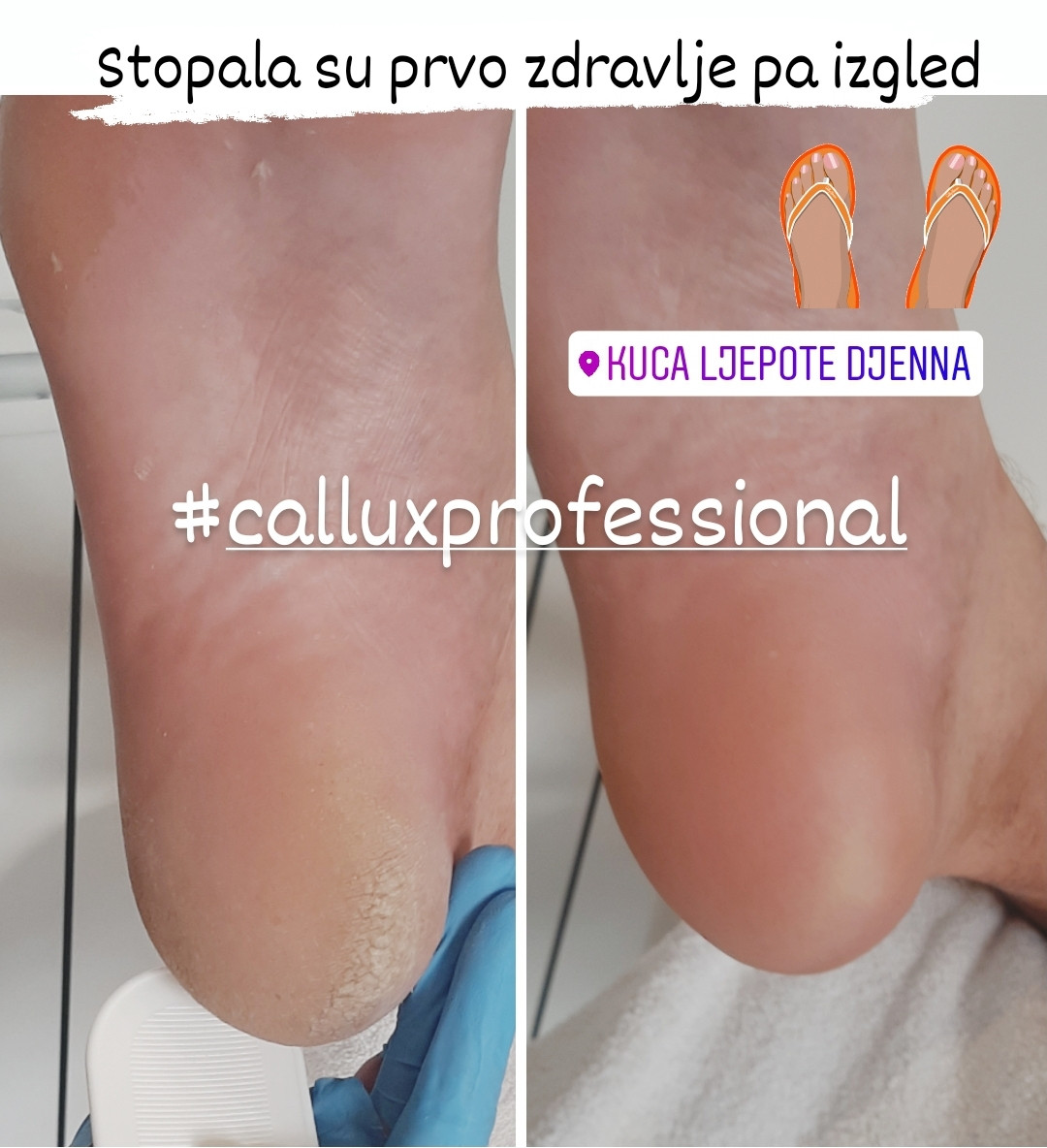 Kuća ljepote Djenna #sarajevo Estetski pedikir Callux pedikir