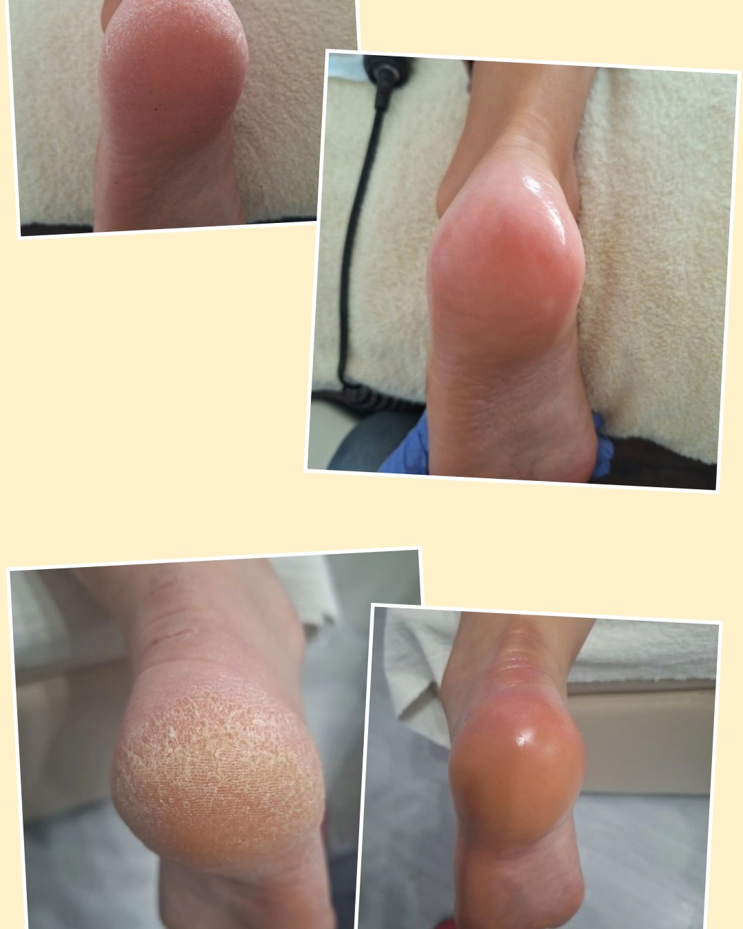 Poezija ljepote #sarajevo Estetski pedikir Ruska pedikura - bez laka