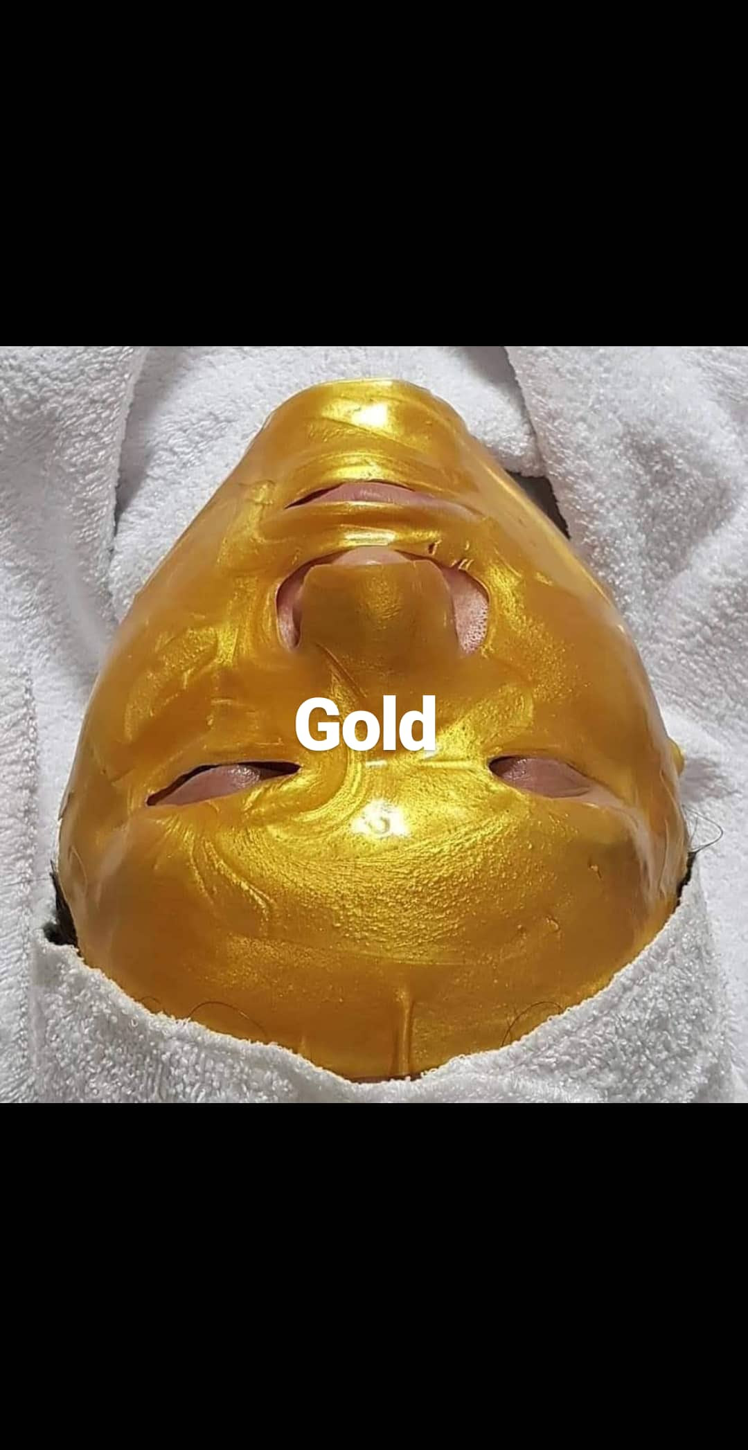 Sandra #visoko Tretman lica Biorevitalizacija lica