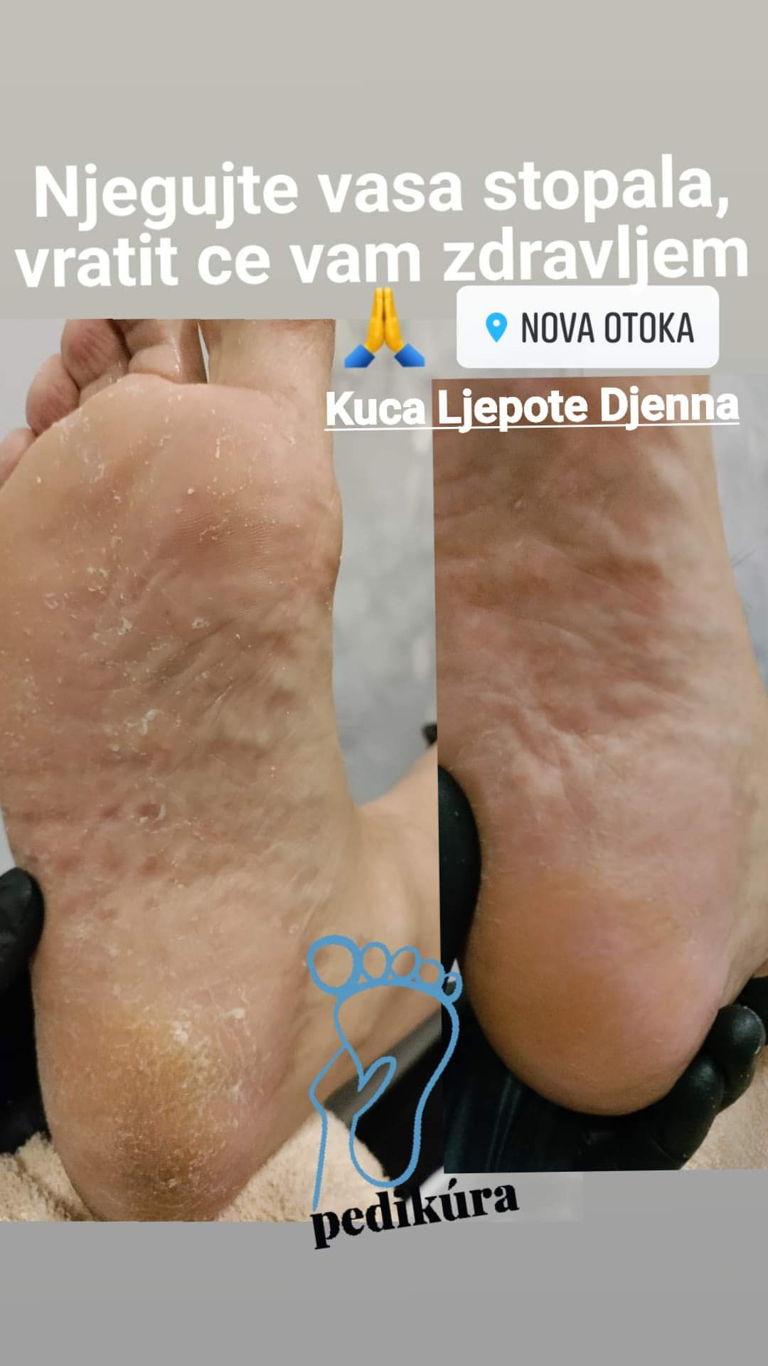 Kuća ljepote Djenna #sarajevo Estetski pedikir Callux pedikir