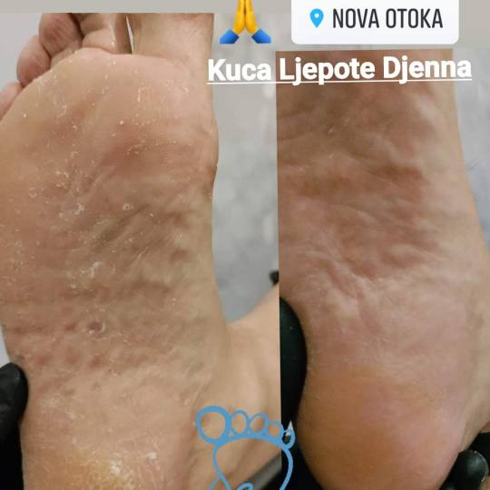 Kuća ljepote Djenna #sarajevo Estetski pedikir Callux pedikir