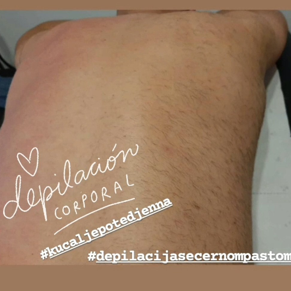 Kuća ljepote Djenna #sarajevo Depilacija šećernom pastom Depilacija leđa šećernom pastom