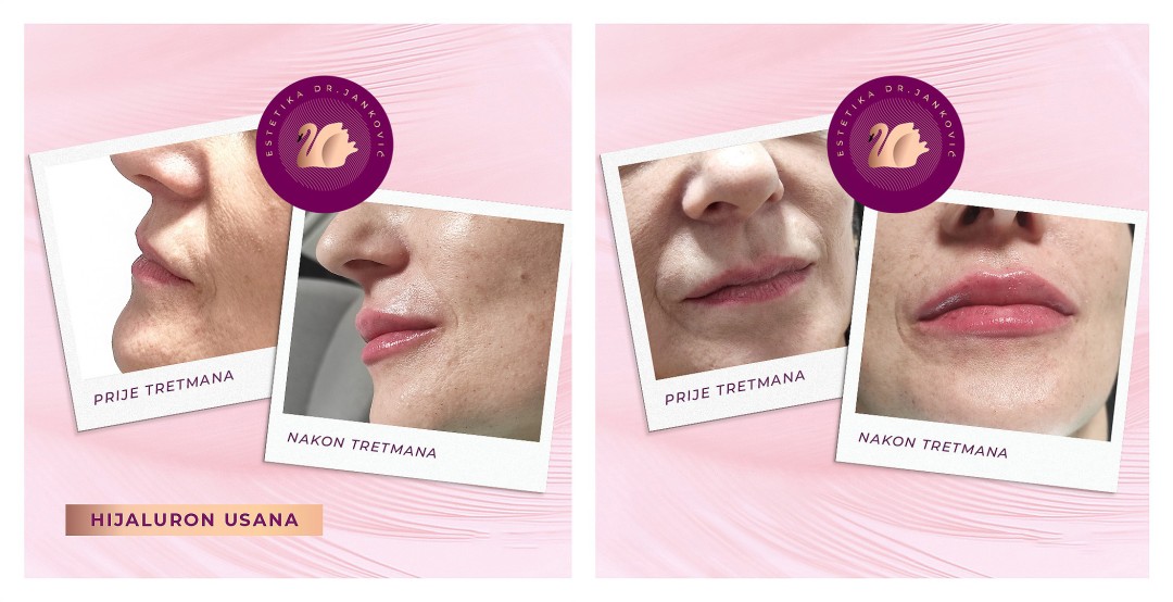 Estetika Janković #banjaluka