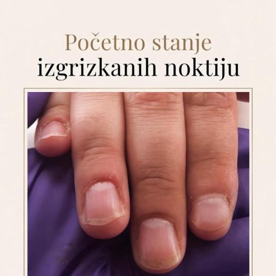 Milana Milaneso #zvornik