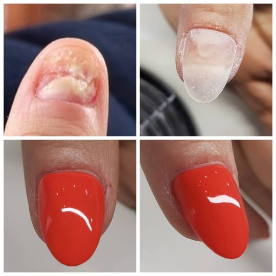 La Vie beauty centar #sarajevo Lakiranje noktiju Rekonstrukcija nokta