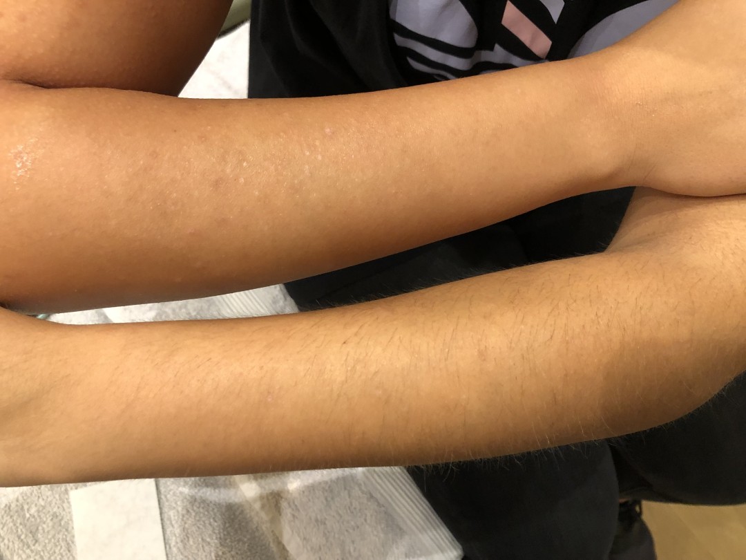 La Crème Beauty Studio #sarajevo Depilacija voskom Depilacija pola ruku hladnim voskom - za dame