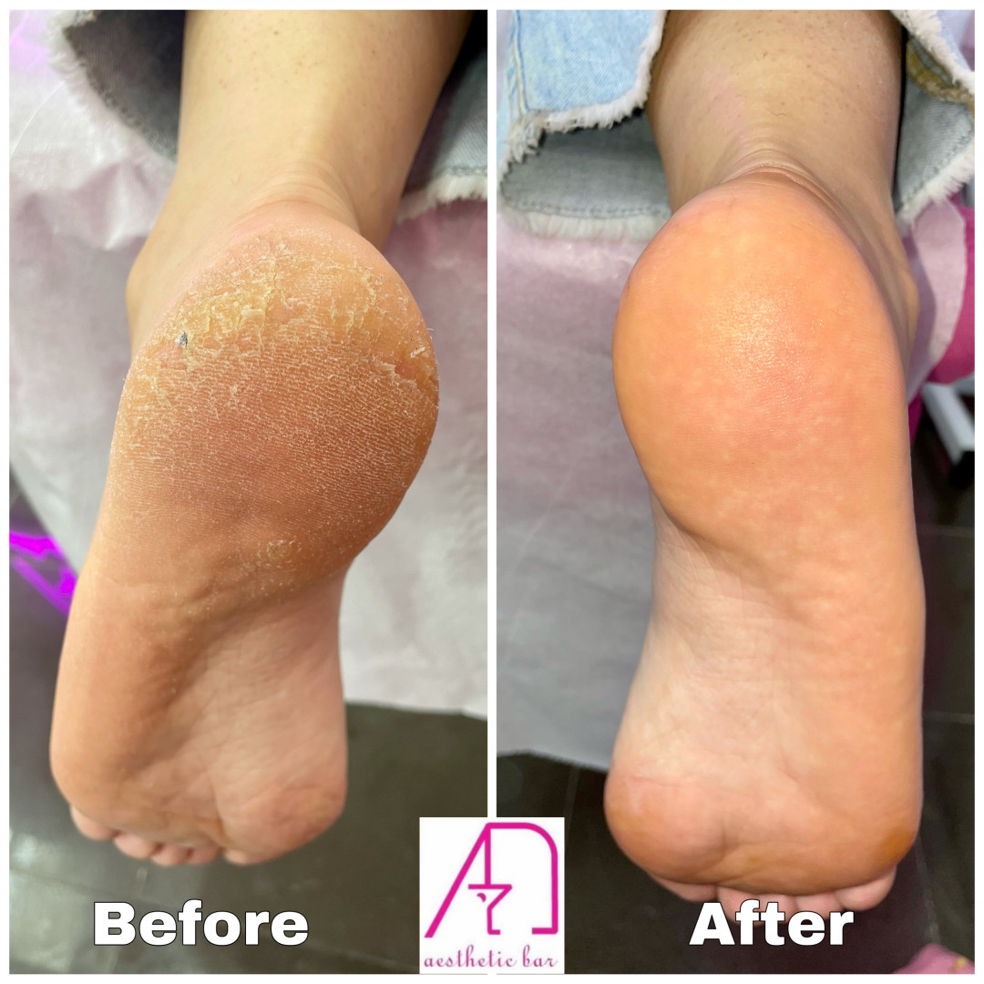 AEsthetic Bar Academy #sarajevo Estetski pedikir Ruski pedikir