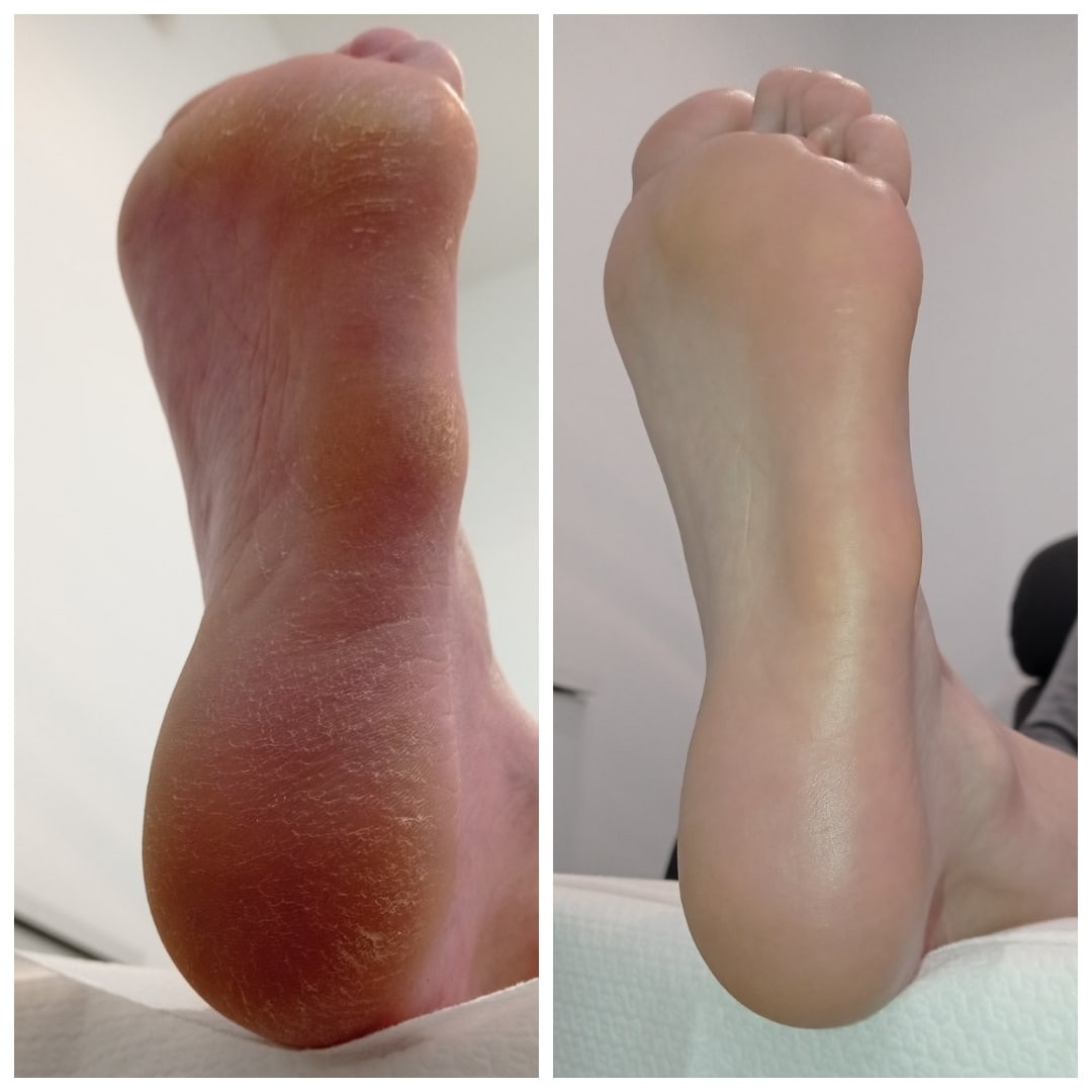 La Vie beauty centar #sarajevo Estetski pedikir Estetski pedikir